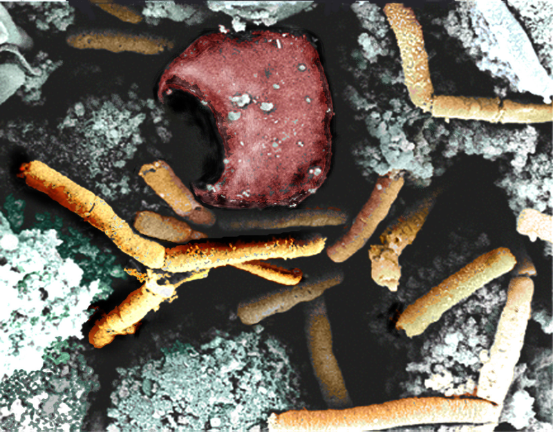 El Bacillus Antracis, visto al microscopio electrónico. Foto: Wikimedia Commons.